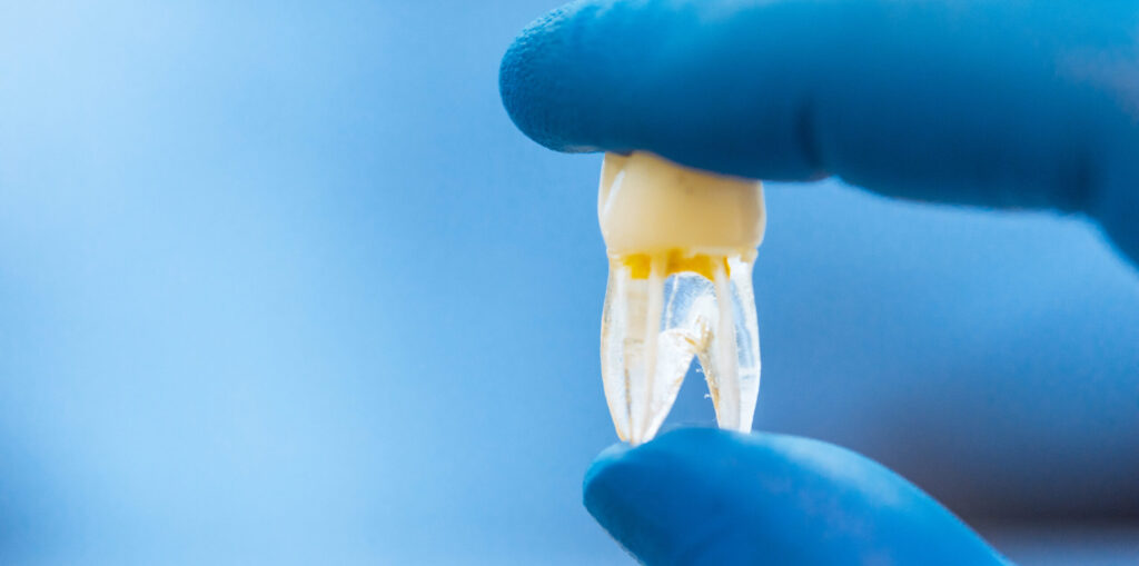 Tooth Regeneration Market
